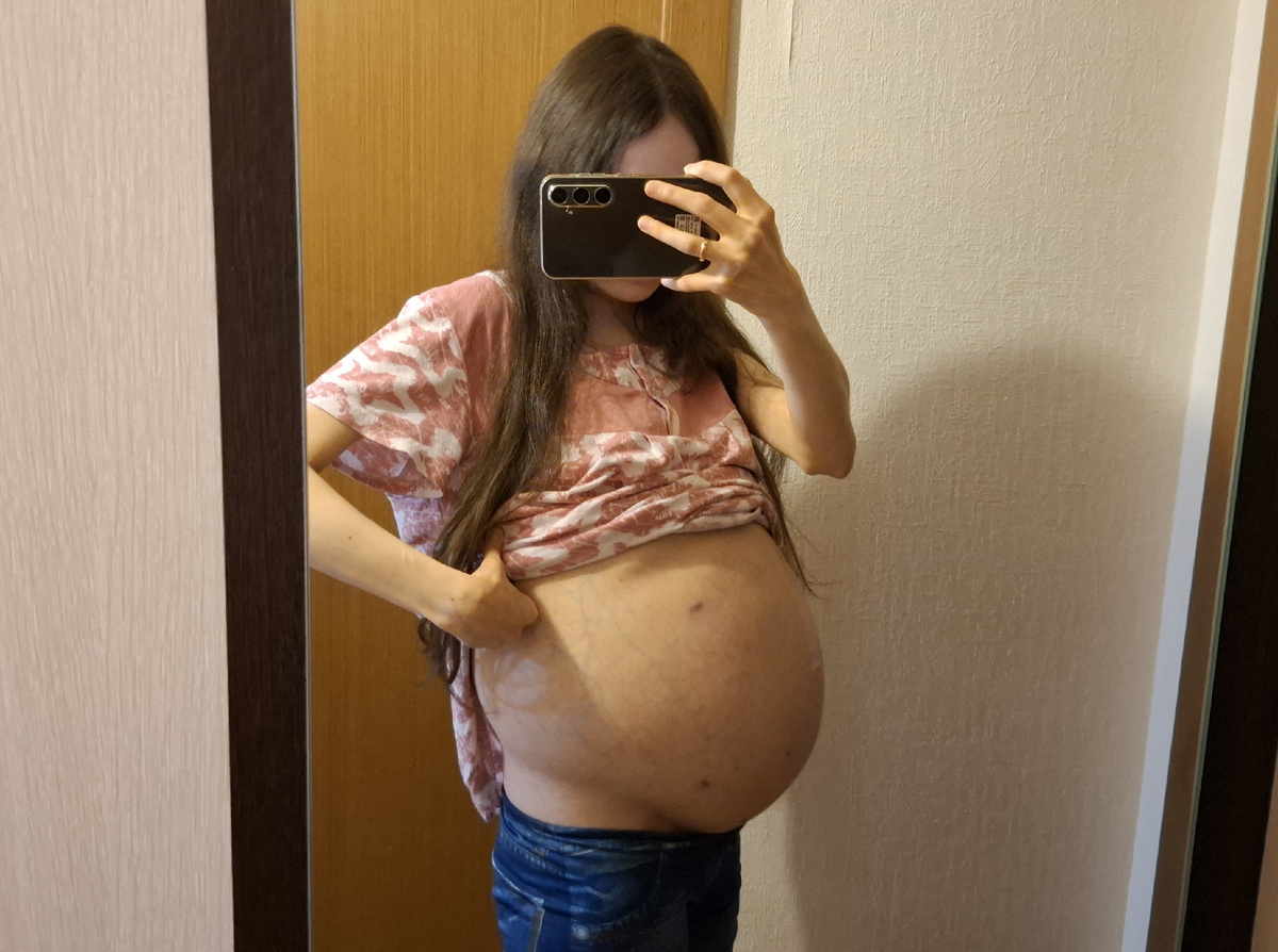 Сбоку раны от операций