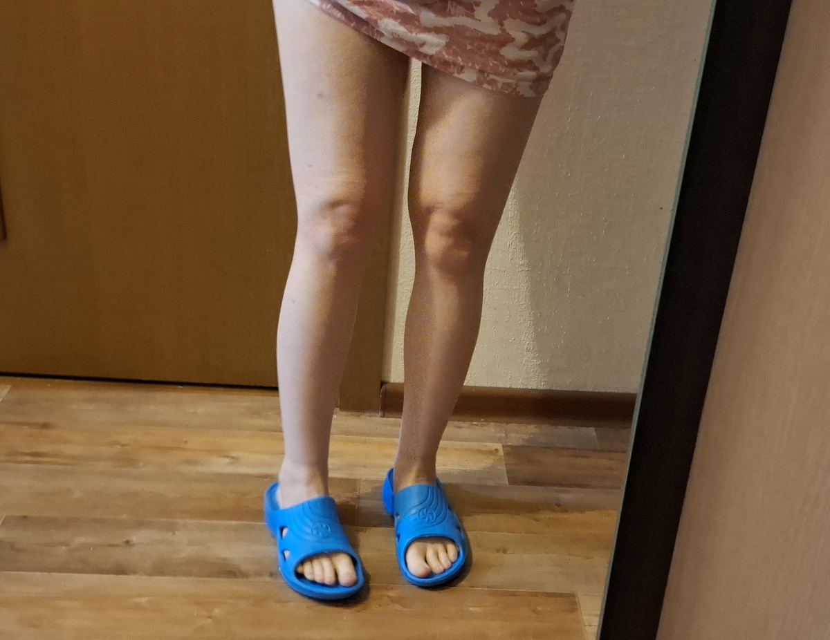 Ноги опять начали стремительно отекать