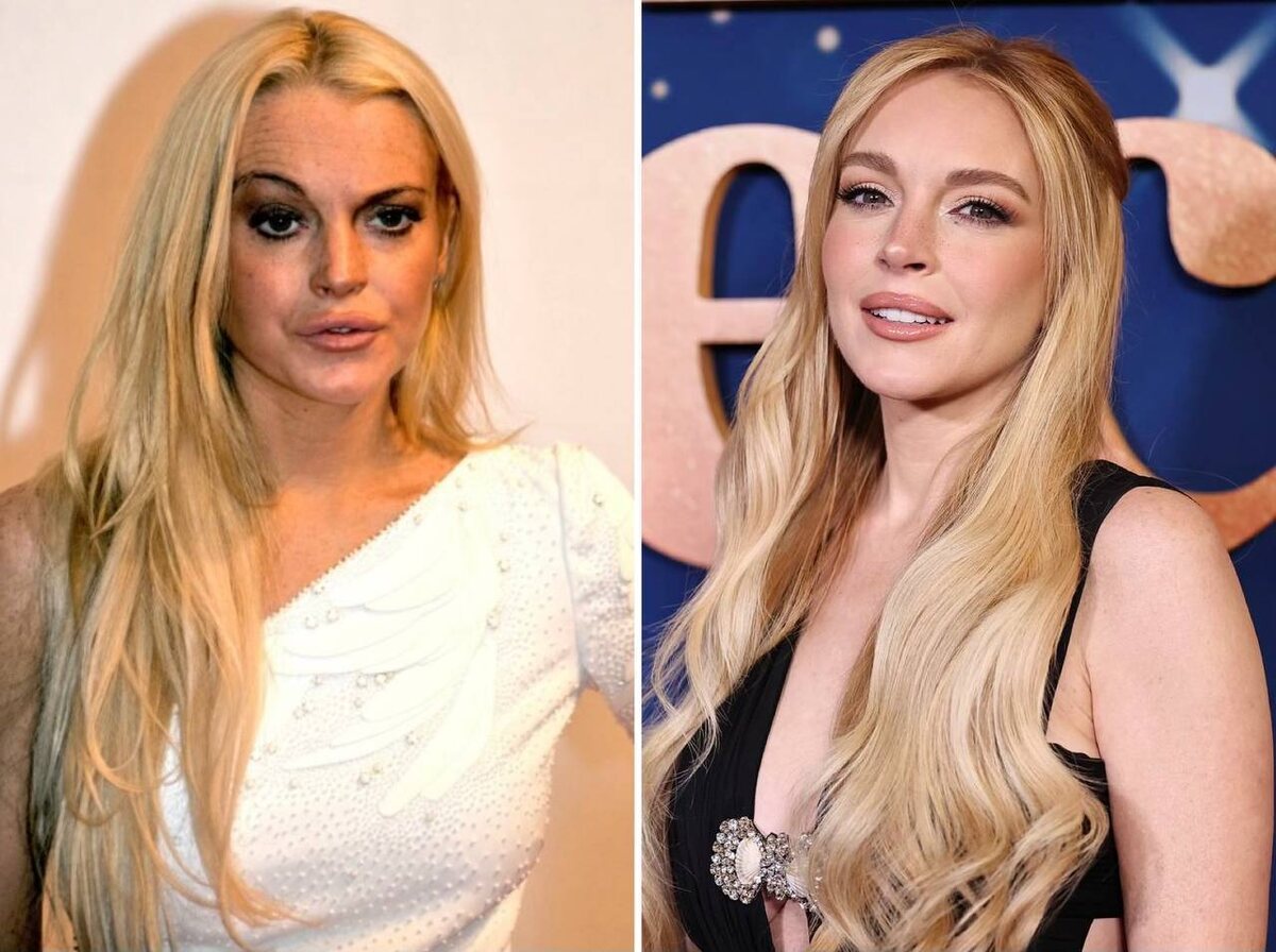 Линдси в эру употребления и в 2025 Источник: яндекс