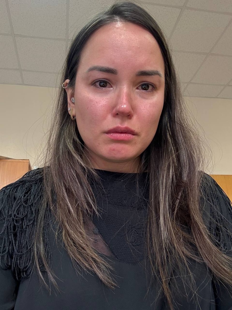    Несколькими днями ранее Екатерина заявила, что ее ударил бывший свекр и разбил ей нос. Фото: личная страница Екатерины Бивол в соцсетях