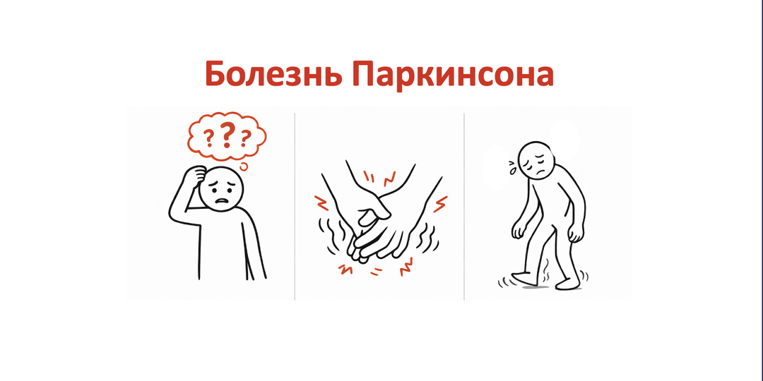 Болезнь Паркинсона
