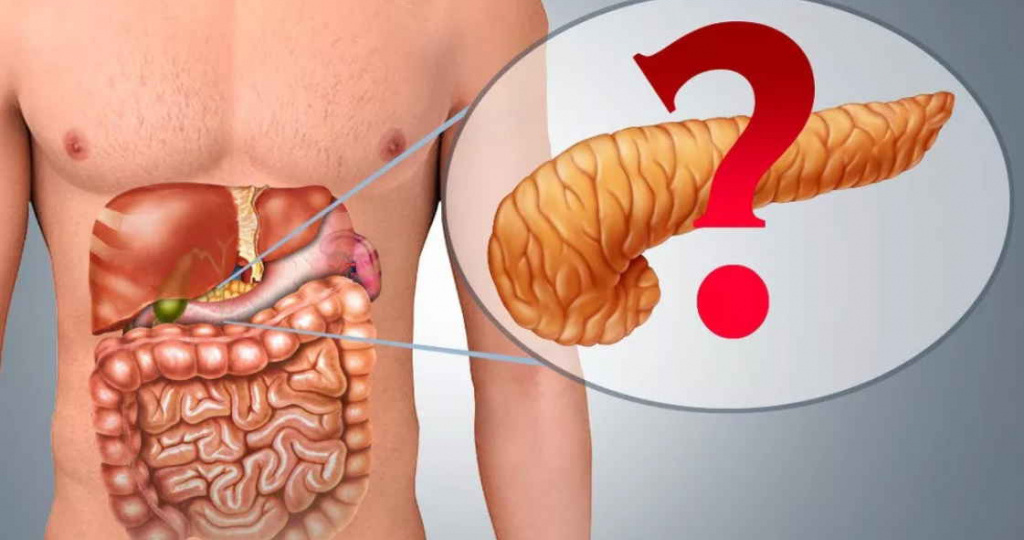 Острый и хронический панкреатит : Как отличить, когда бежать к врачу и чем лечить