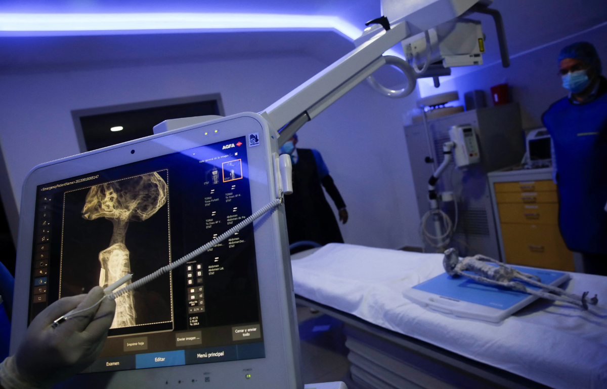 Новое исследование подтвердило подлинность мумии. (Фото: nypost.com).