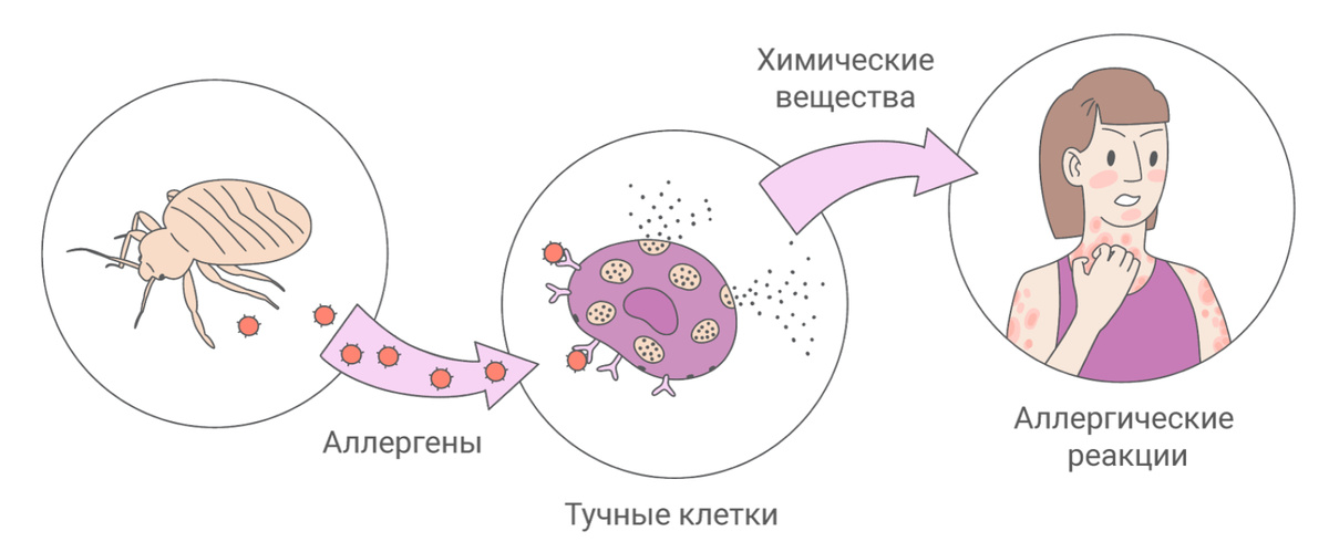 Симптомы аллергии: высыпания и реакции, которые приходят неожиданно