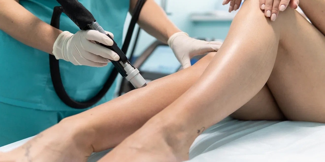 Мини-викторина: правда или миф о лазерной эпиляции?