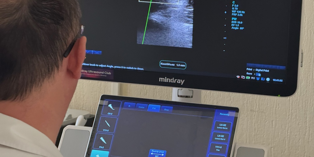 Когда в Екатеринбурге особенно важно обследовать сосуды: признаки, сезоны и группы риска