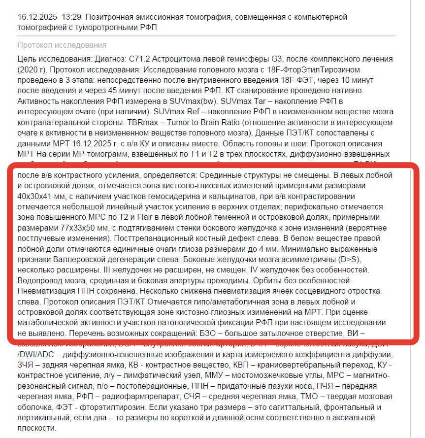 Результат обследование Роминого головного мозга ПЭТ КТ в Димитровграде.