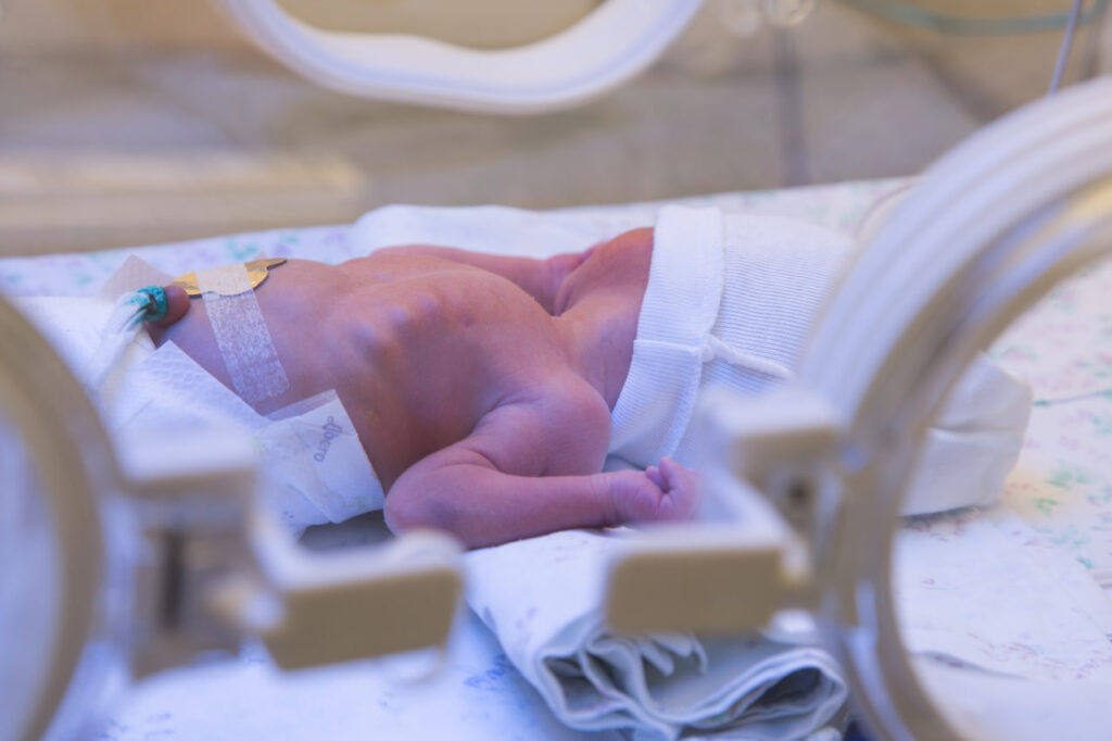    Если кислород не поступает в мозг на протяжении максимум пяти минут, то это может привести к необратимым последствиям. Автор фото: Наталья Русинова