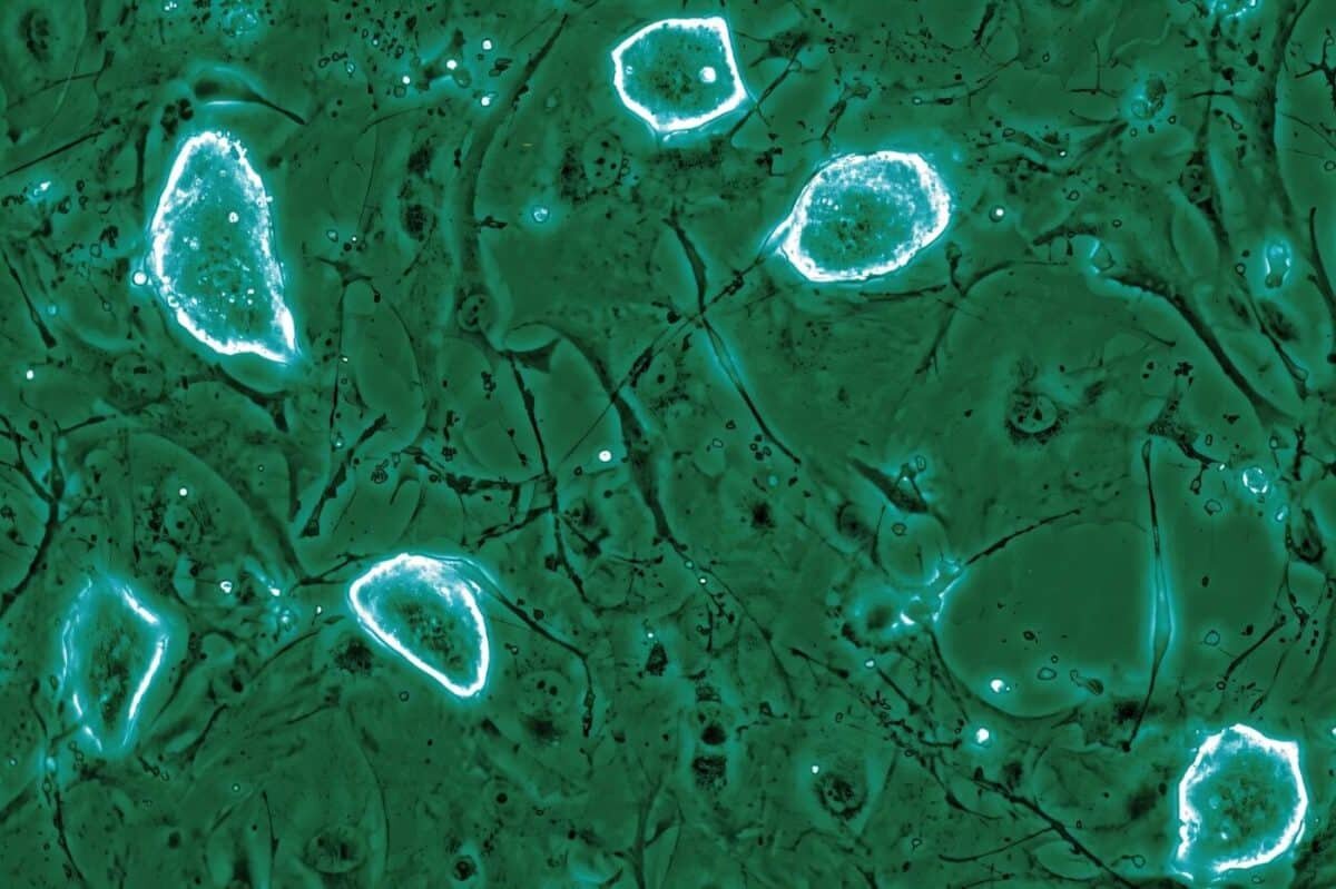    Колонии эмбриональных стволовых клеток мышей в состоянии диапаузы / © Tarakhovsky lab