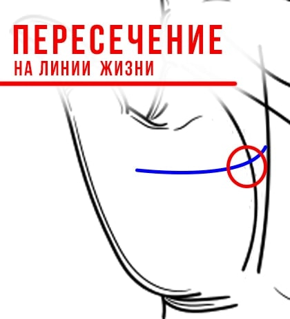 Линия стресса пересекает линию жизни - значительный стресс. https://hiro.su/nikolay/linii/liniya-stressa/