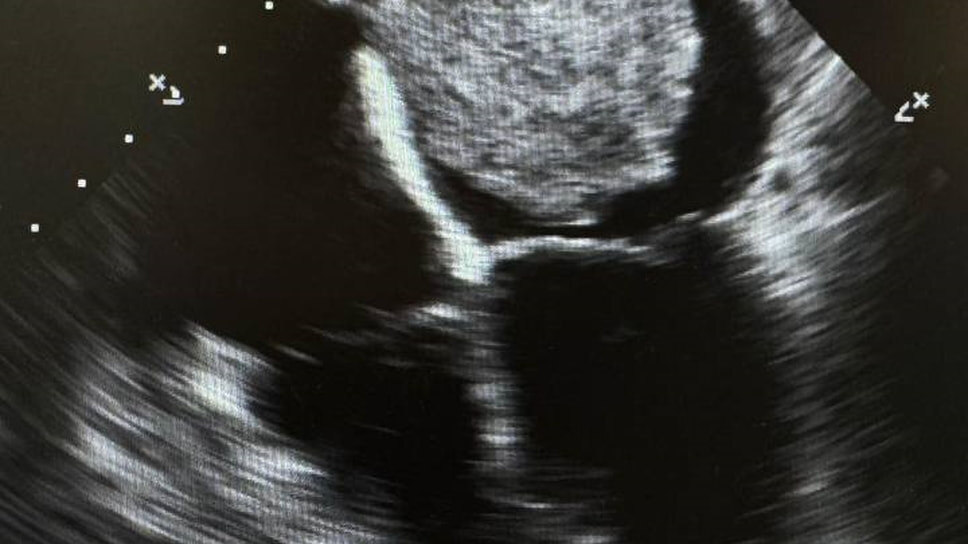 Фото: ГБУ РД Научно-клиническое объединение «Дагестанский центр кардиологии и сердечно-сосудистой хирургии