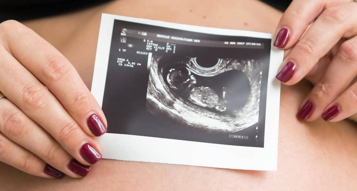    Алексей Смышляев, Коммерсантъ с сайта iy.kommersant.ru