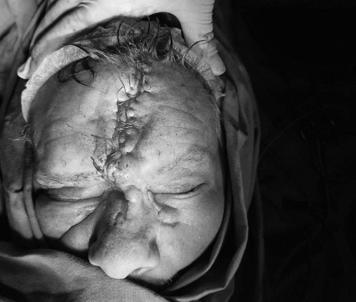    Фото: пресс-служба Минздрава МО
