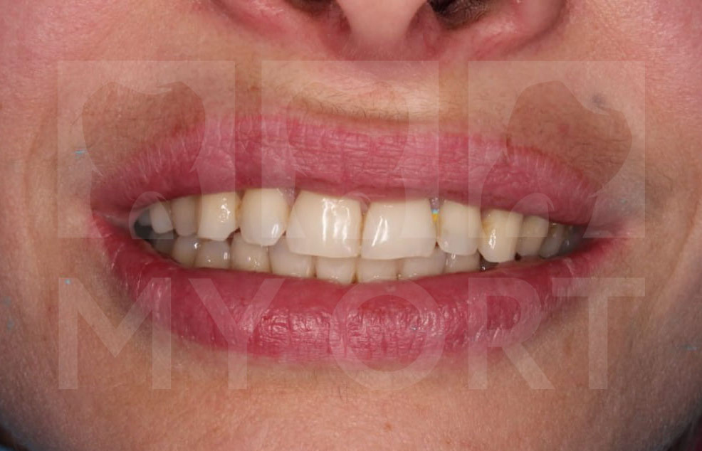 Фото до лечения