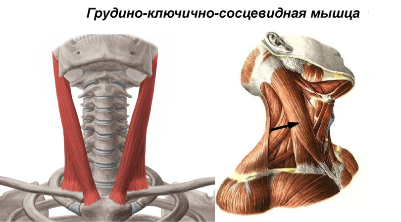 Грудинно-ключично-сосцевидная мышца: Головокружение и шум в ушах | Возможно, дело не в шее | Техника самодиагностики
