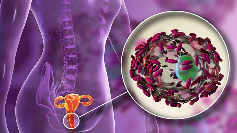 Нарушение микрофлоры влагалища