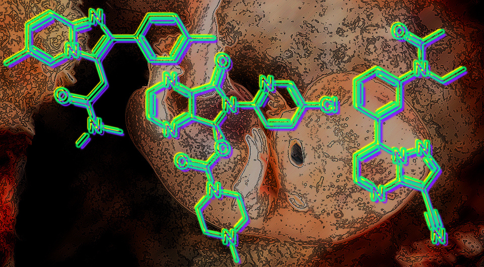   N + 1; lunar caustic / Flickr / CC BY 2.0; Fuse809 / Wikimedia Commons / CC BY-SA 3.0; Harbin / Wikimedia Commons / Public Domain; Fvasconcellos / Wikimedia Commons / Public Domain