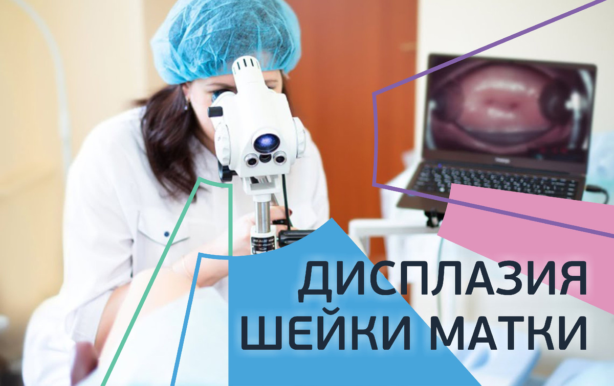 Дисплазия шейки матки. Что это такое и почему важно вовремя пройти обследование