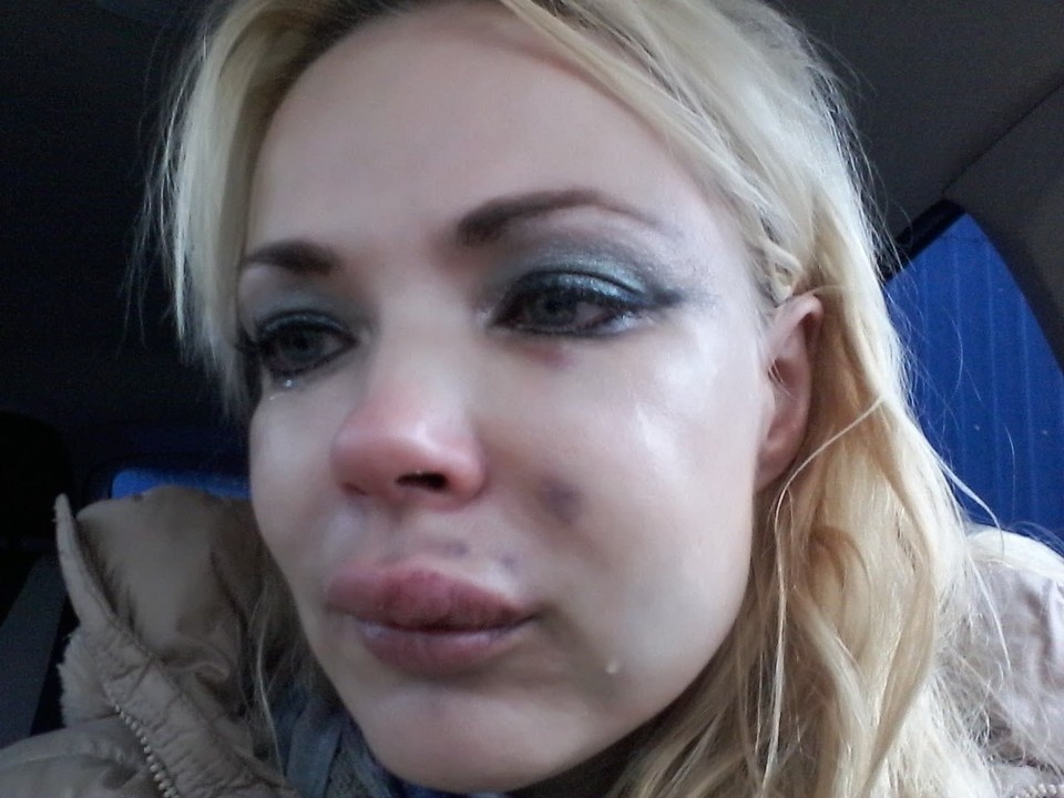 Женщина боялась обращаться в полицию, чтобы зявить о побоях со стороны мужа. Фото опубликовано «КП-Петербург»