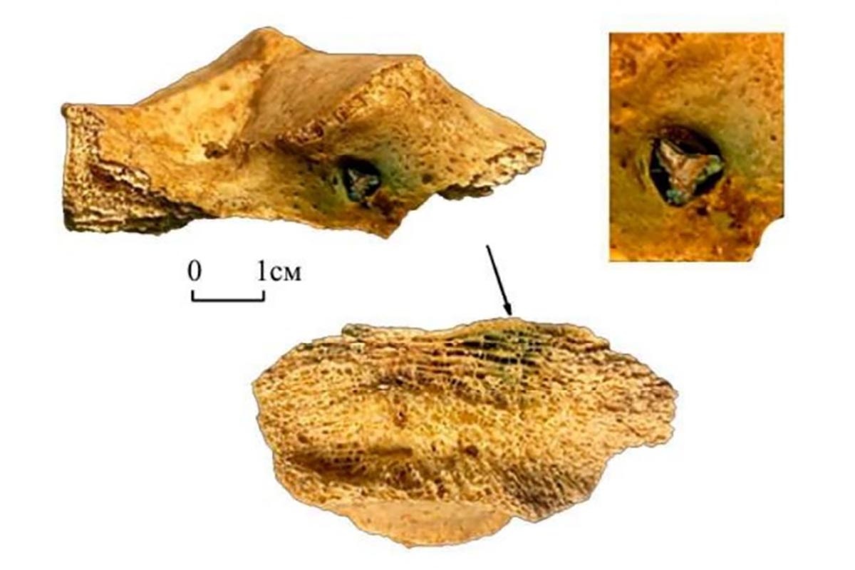    После ранения мужчина выжил. Но травма давала о себе знать. / pifk.magtu.ru