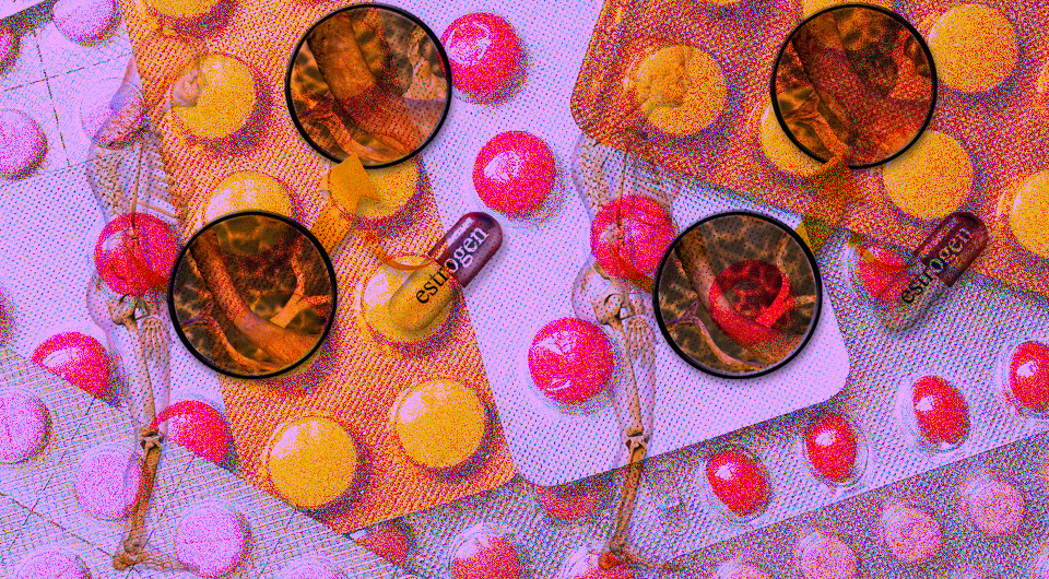   N + 1; Picryl / CC0; BruceBlaus / Wikimedia Commons / CC BY-SA 4.0