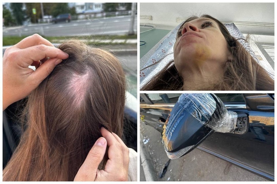    Сибирячку жестоко избила компания пассажиров, а, кроме того, разбили и автомобиль. Фото: архив героев публикации