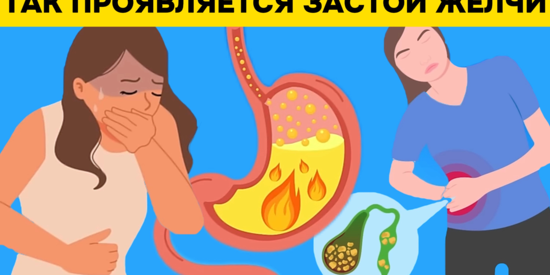 Почему «желчь застаивается»: проблема, которая разрушает здоровье изнутри