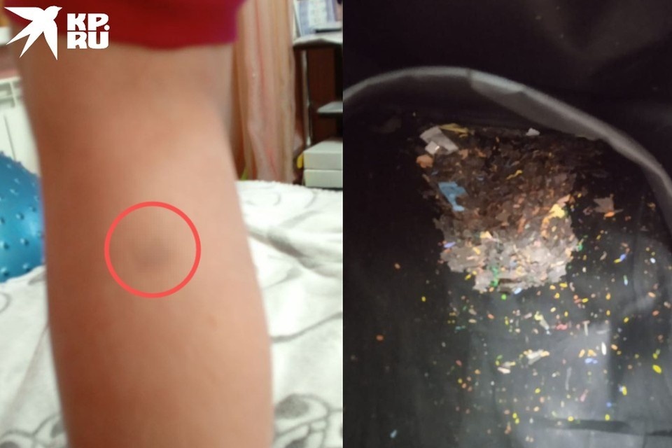    Школа отрицает травлю, но признает конфликты между девочками. Фото: Предоставлено отцом ребенка