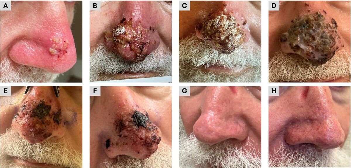   Ricardo Villanueva Gaona et al. / BMJ Case Reports, 2025