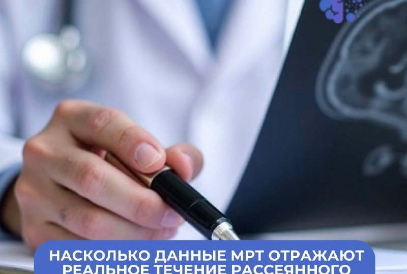 Насколько данные МРТ отражают реальное течение рассеянного склероза