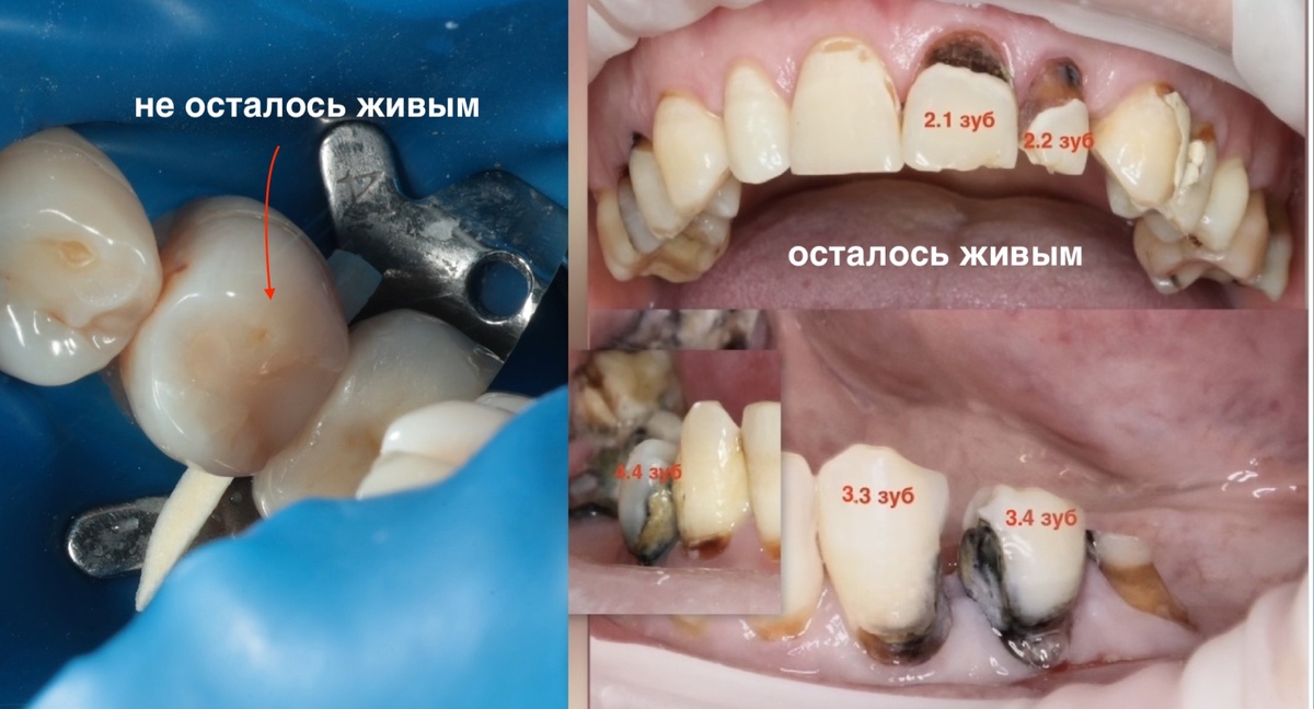 Такие разные зубы и судьбы