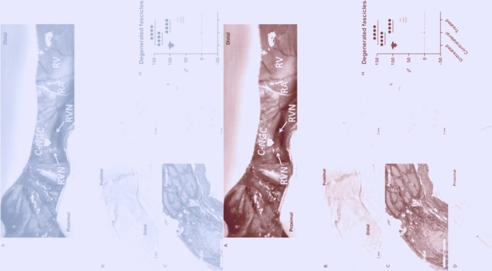   N + 1; Vincenzo Lionetti et al. / Science Translational Medicine, 2025