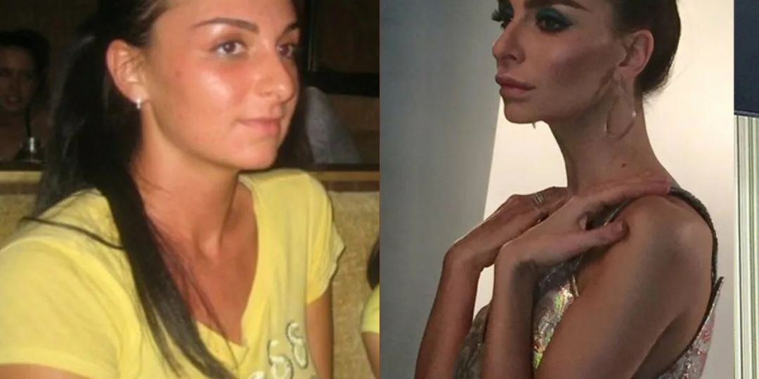 15 знаменитостей, сбросивших много лишнего