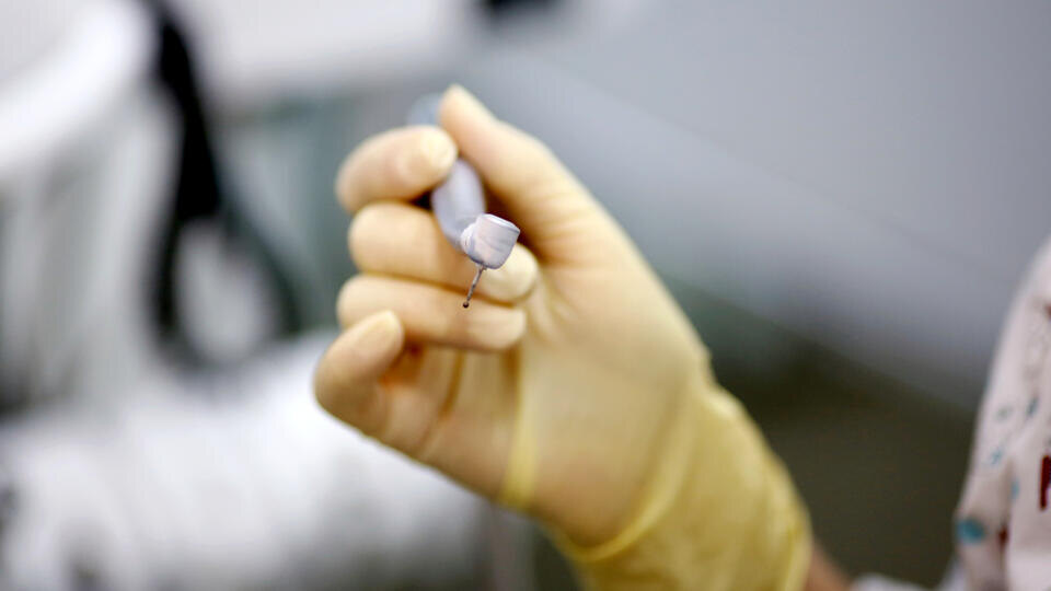     Банда стоматологов задержана в России за вырывание здоровых зубов у пациентов РИА Новости/Кирилл Брага