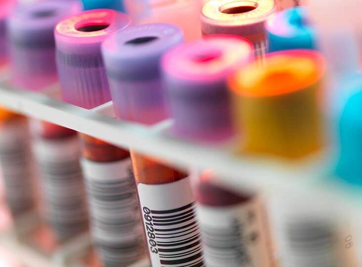 Назначение тестов на онкомаркеры с целью проверить, есть ли рак, абсолютно бессмысленно