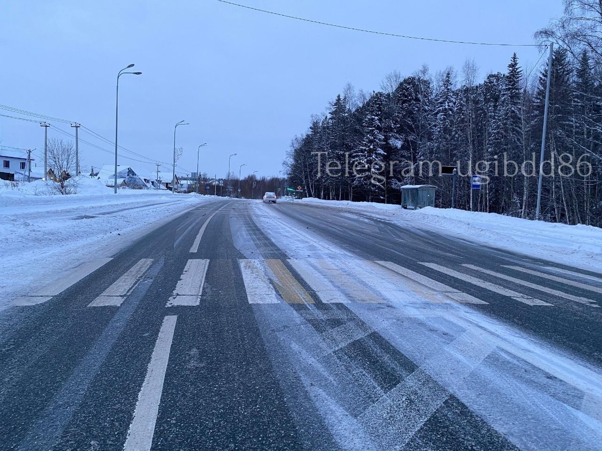    В столице Югры автомобиль сбил несовершеннолетнего