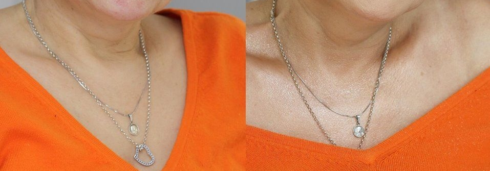 После 50 лучше так не делать или идеальная комбинация для визуального улучшения кожи шеи и декольте