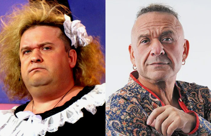    Комик Александр Морозов, сбросивший 80 килограммов после операции.