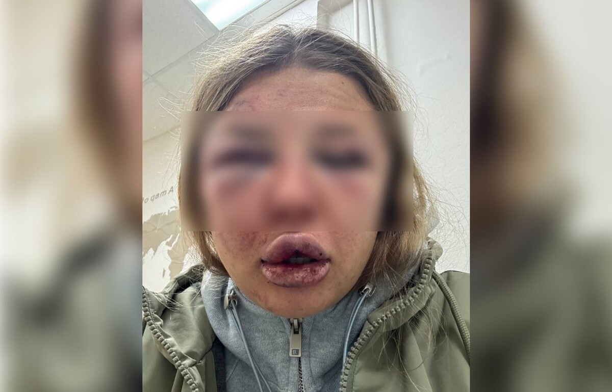    Пострадавшая / Источник: Социальные сети