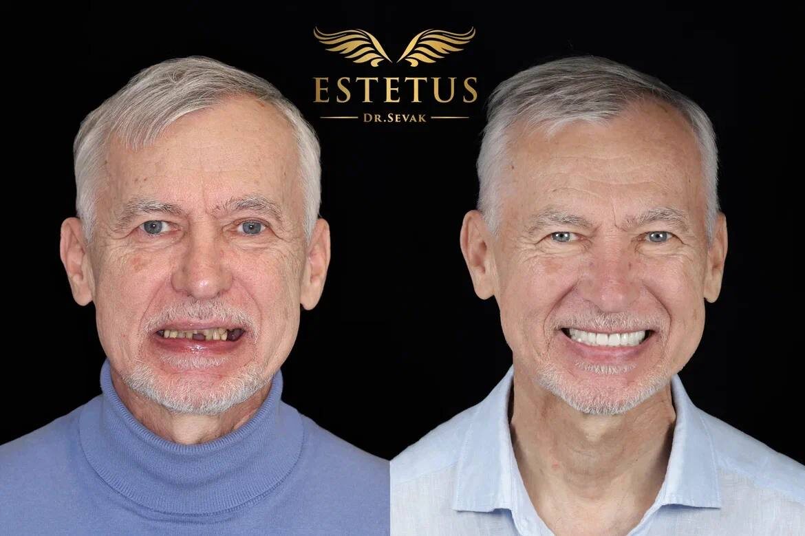 Александр Владимирович, г. Москва, клиника доктора Севака Estetus