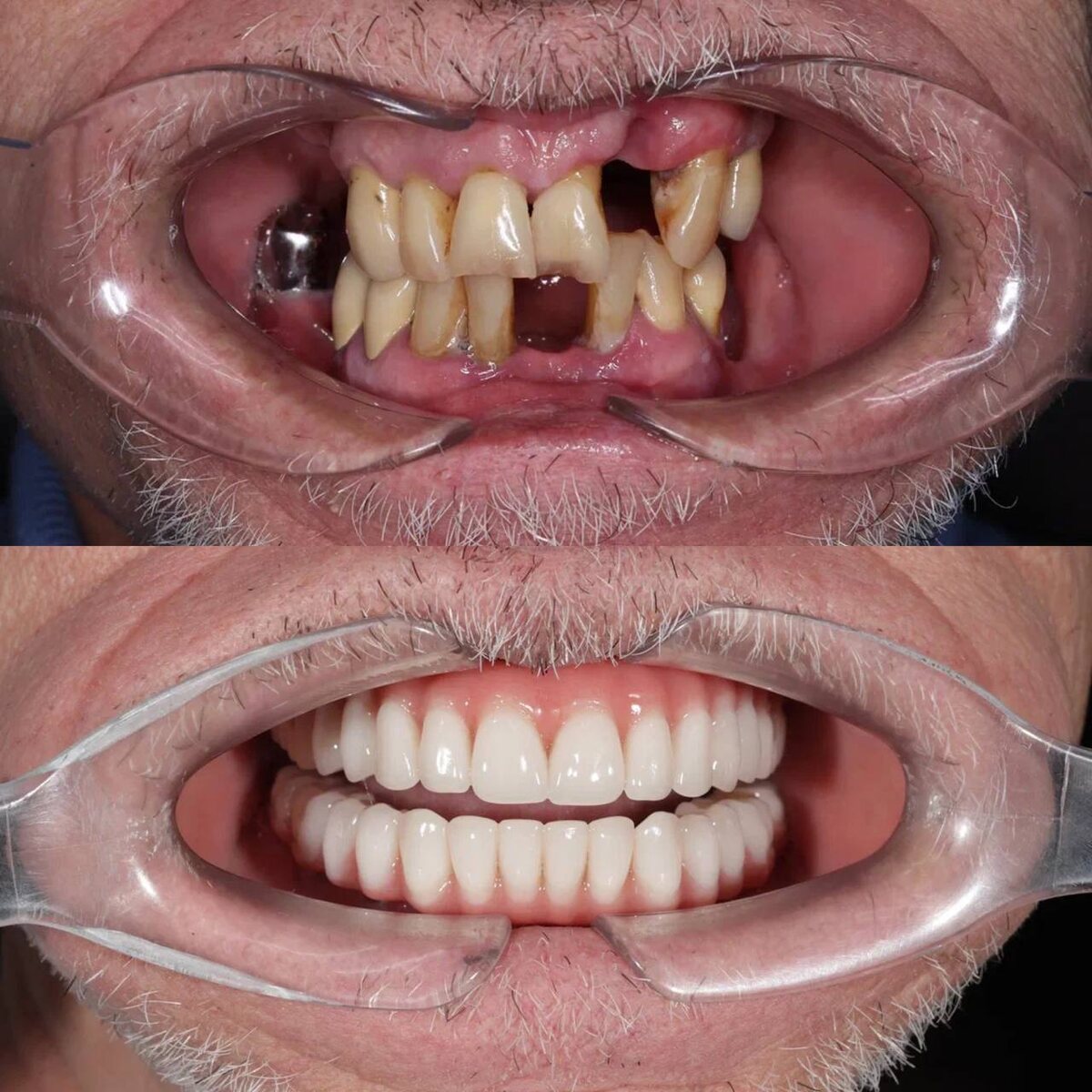 Александр Владимирович, г. Москва, клиника доктора Севака Estetus