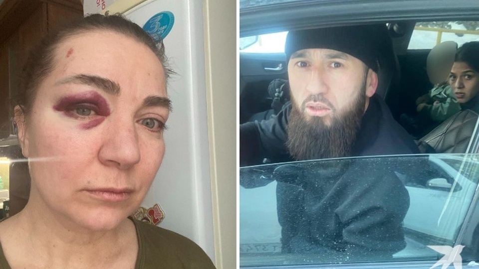 Не видит глаз, не смыкается челюсть: учительницу, обучающую детей-инвалидов, избили из-за парковочного места