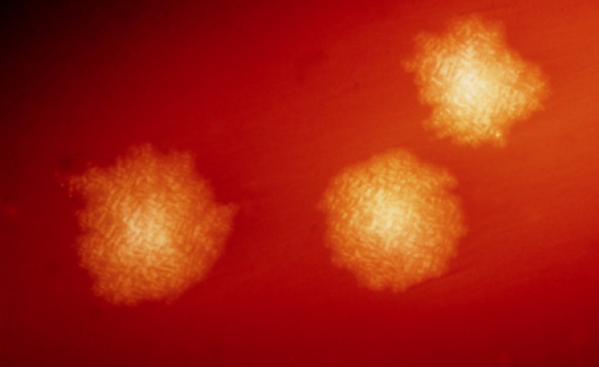    Бактерии Clostridium difficile. Источник изображения: wikimedia.org