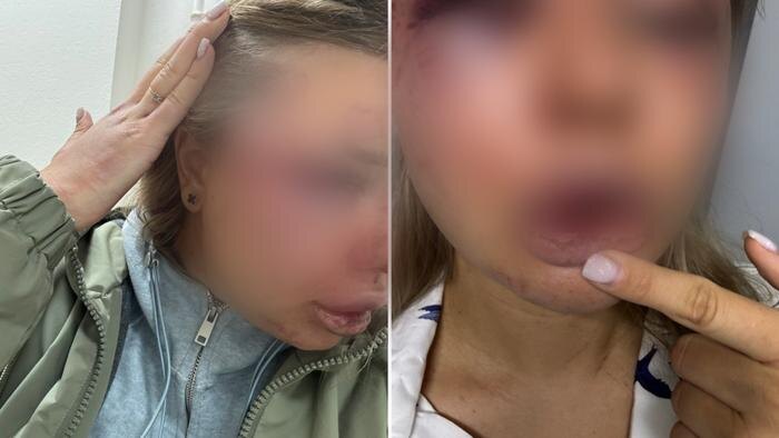 Фото © Telegram / Новости Твери и Области