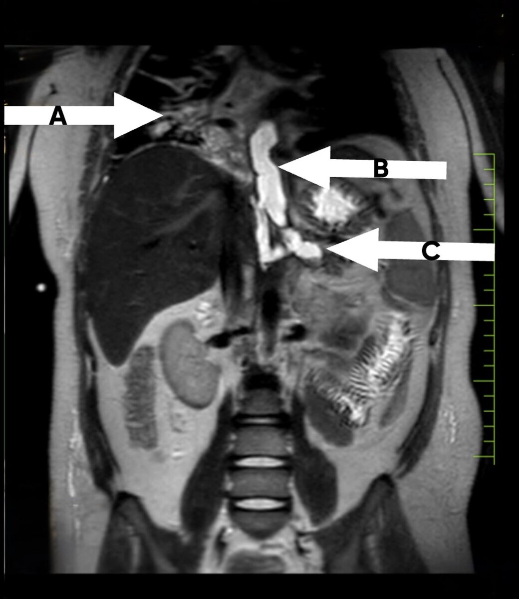   Hans Vaish et al. / BMJ Case Reports, 2025