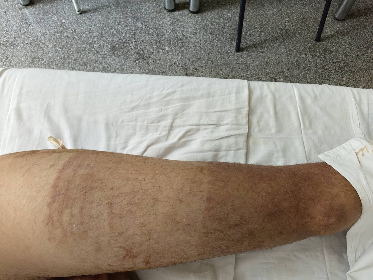 Фото ноги от 20.07.2025 г.