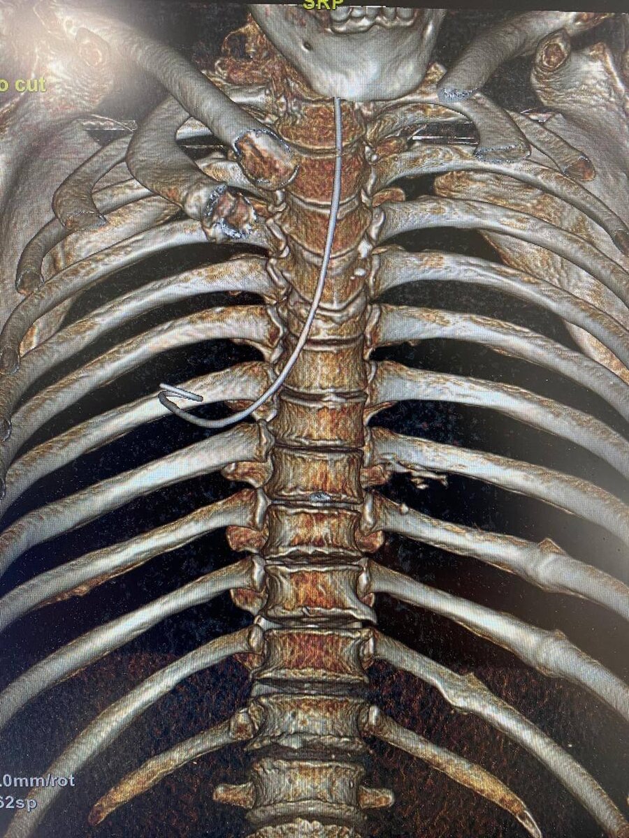 Снимки для постановки диагноза: листайте карусель, чтобы посмореть все изображения