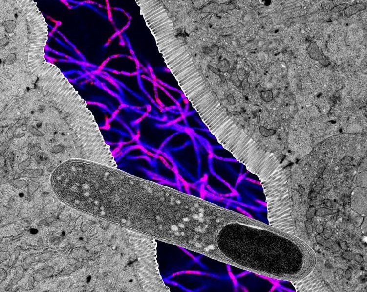 Коллаж из микроскопических изображений, демонстрирующий палочковидную бактерию Turicibacter (на переднем плане), поперечный срез кишечника и флуоресцентную микроскопию других бактерий (на заднем плане). Изображения не в масштабе. Автор: Кендра Клаг, доктор философии.📷    Одна из 100 кишечных бактерий препятствует ожирению и снижает уровень сахара в крови
