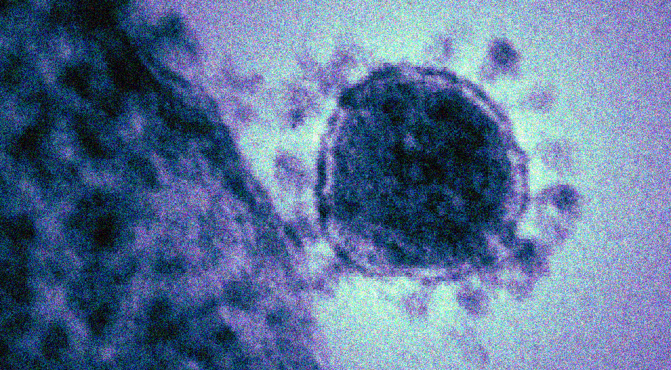   NIAID / Wikimedia Commons / Public Domain