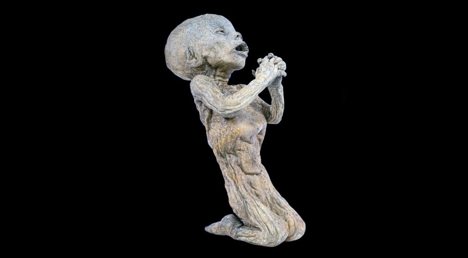   Omar Larentis et al. / Frontiers in Medicine, 2025